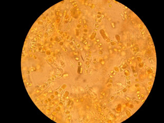 Photographie de la cyanobactérie ''Hyella caespitosa'' trouvé dans le lichen « Pyrenocollema halodytes »